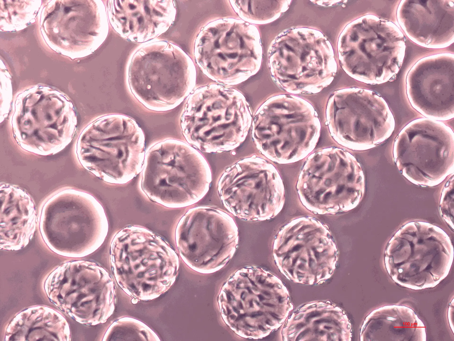 adherent cells microcarriers microscopy