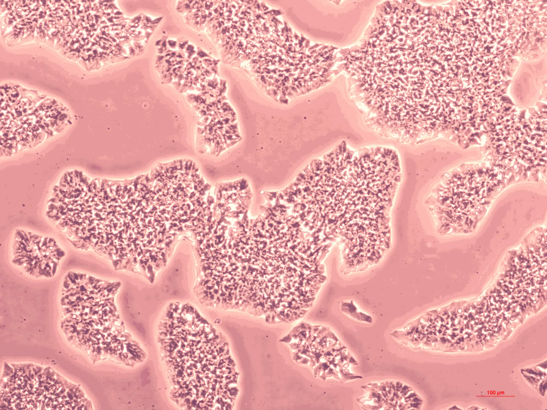 microscopic adherent ipsc