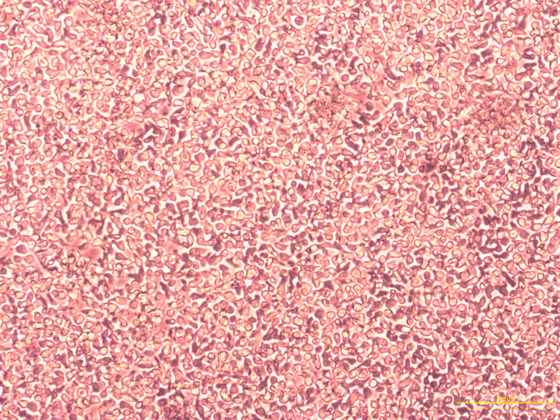 microscopy picture suspension cells