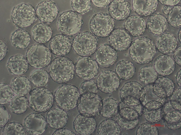 HEK293T cells on microcarriers